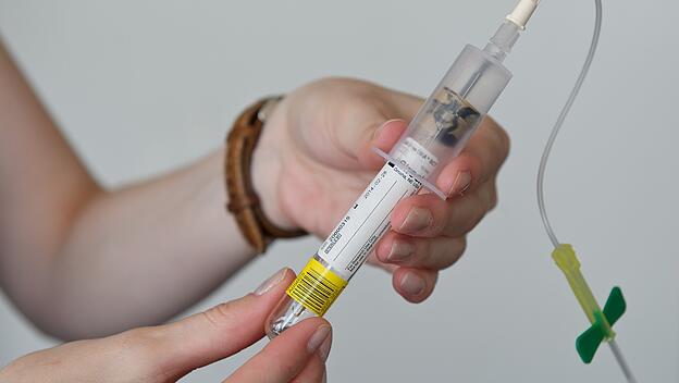 Down-Syndrom-Bluttest