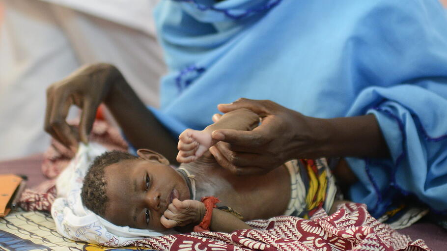 Unterernährtes Kind im Senegal