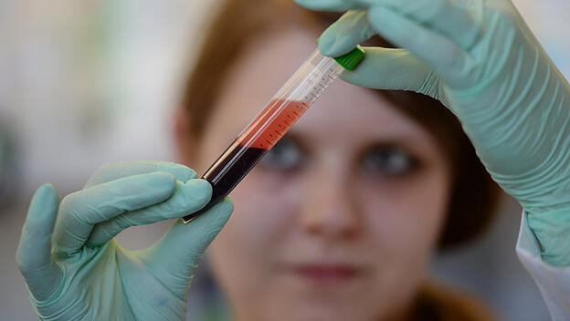 Debatte um Trisomie-Bluttest