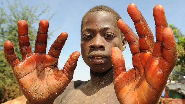Sklaverei:  Ein Kind zeigt seine Hände in der Goldmine Poushgin in Zorgho