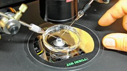 Unter dem Mikroskop führen Reproduktionsmediziner Spermien in Eizellen ein