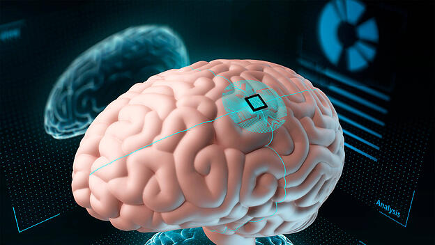 Microchips zur Gesundheitskontrolle im Gehirn?