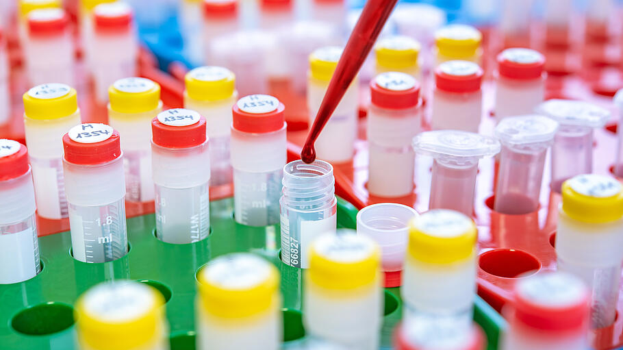 Pränatale Bluttests als Kassenleistung