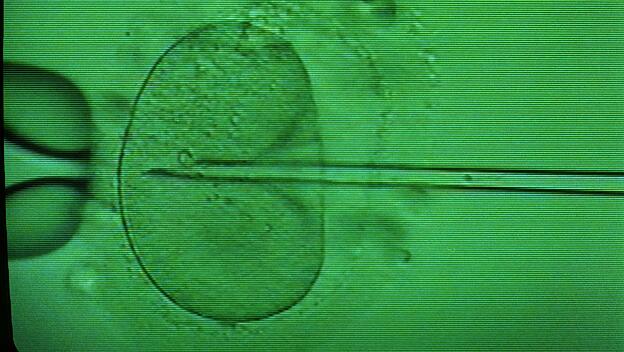 Einbringen einer Samenzelle in eine Eizelle mittels Mikropipette