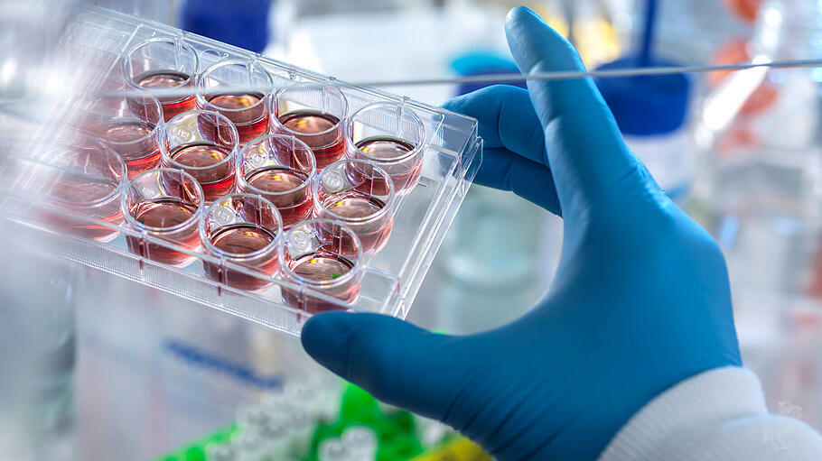 Technician holding multi well plate with blood samples in laboratory model released Symbolfoto property released ABRF008