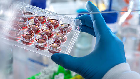 Technician holding multi well plate with blood samples in laboratory model released Symbolfoto property released ABRF008