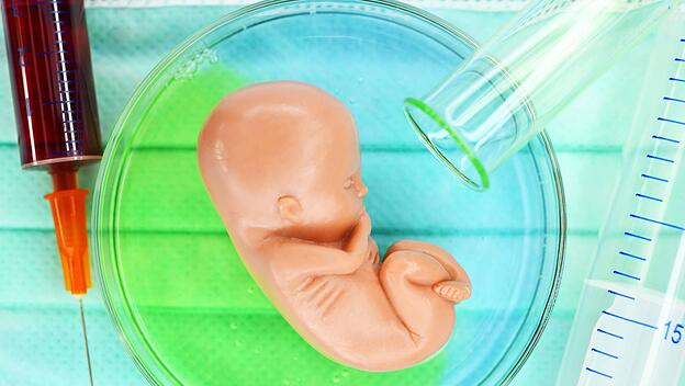 Fötus Figur in einer Petrischale Symbolfoto Pränataldiagnostik *** Fetal figure in a Petri dish Sym