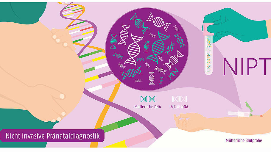 Nicht invasive Pränataldiagnostik