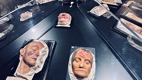 Wachsabformungen von Krankheitsph&auml;nomenen in der Medizin