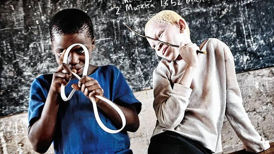 Unicef Foto des Jahres 2009 - Albino