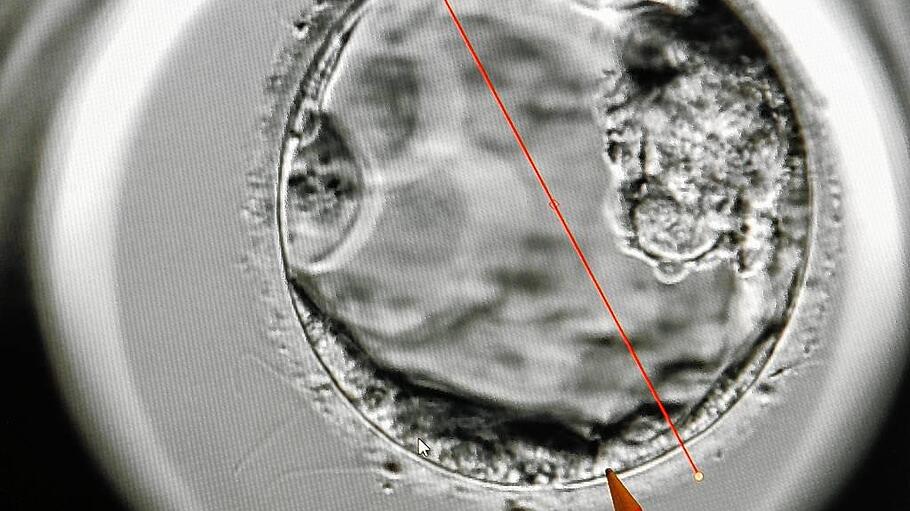 Embryo unter einem EmbryoScope
