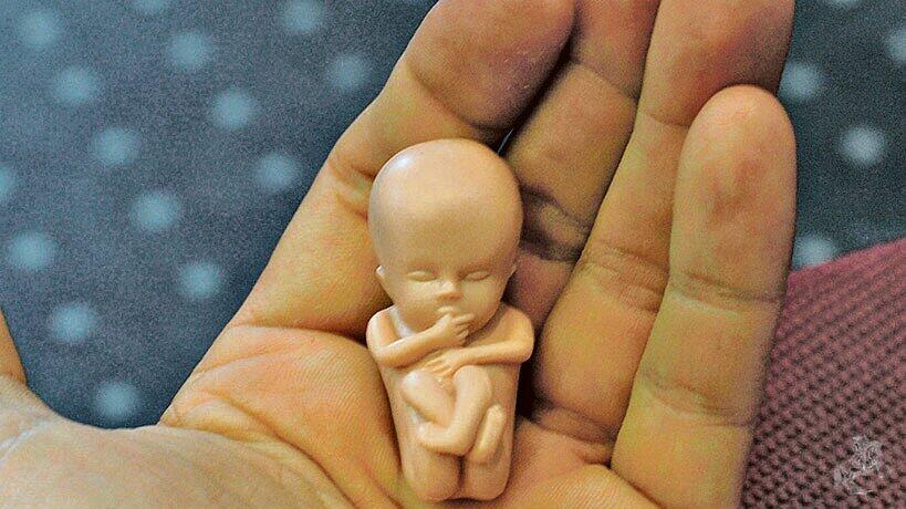 Foetus