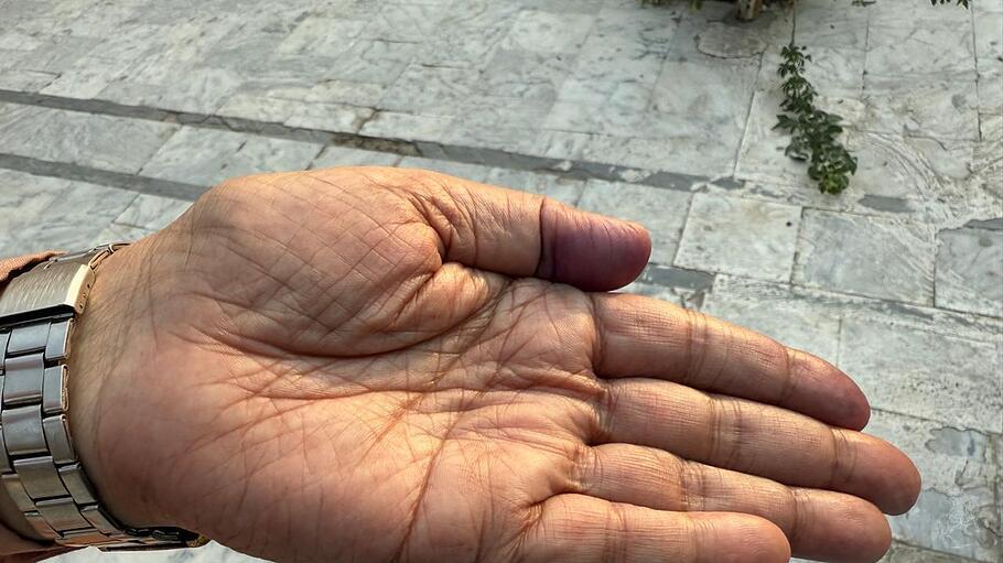 Anwar Kenneths Hand