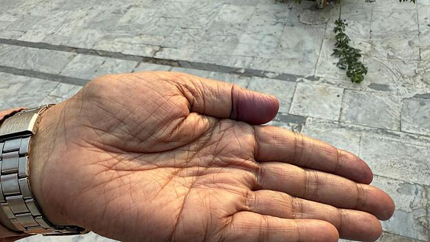 Anwar Kenneths Hand