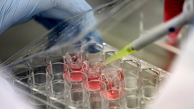 Erzeugung „embryoähnlicher Strukturen“ aus im Reagenzglas